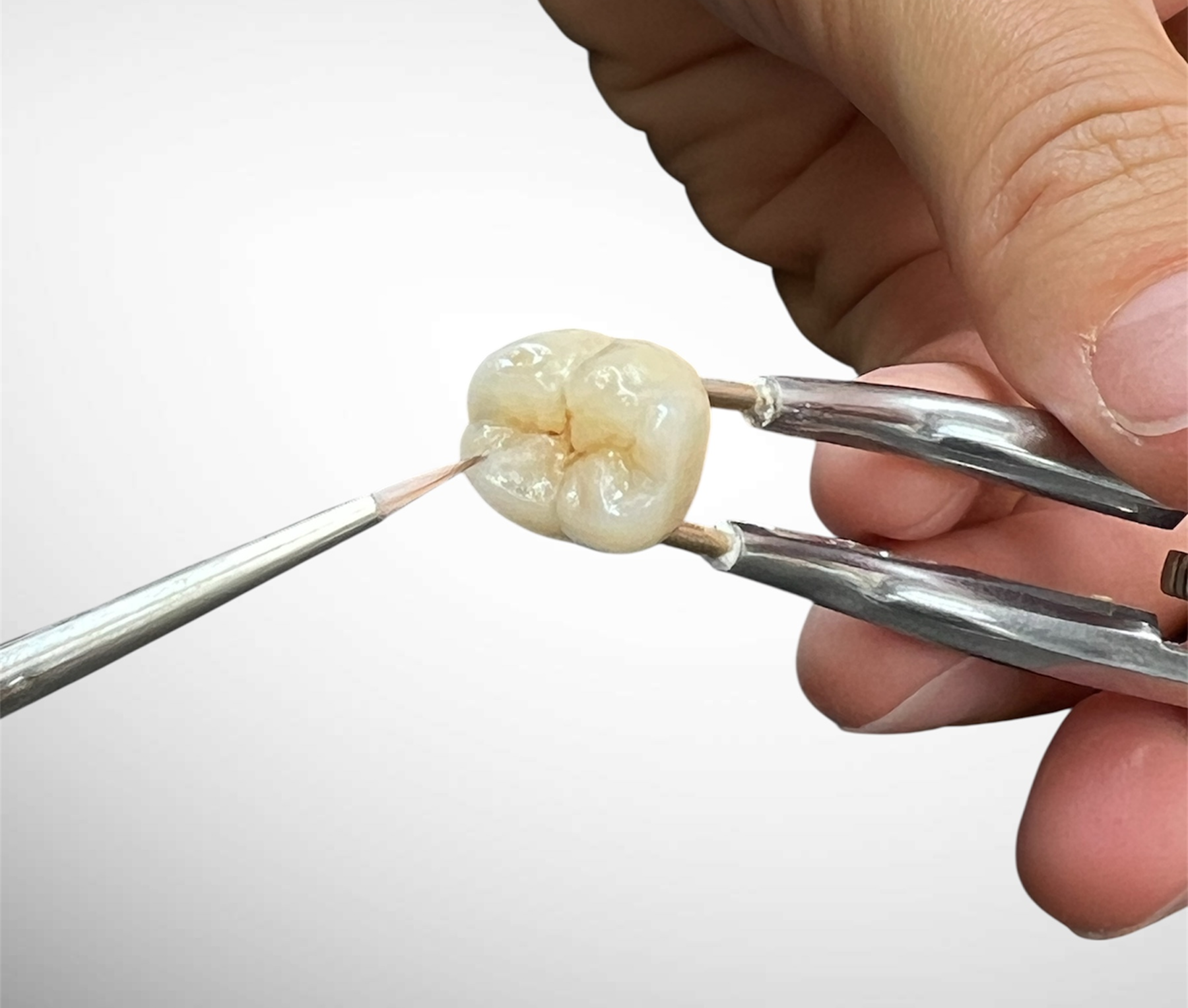 imgi_18_Full-zircone-1 1